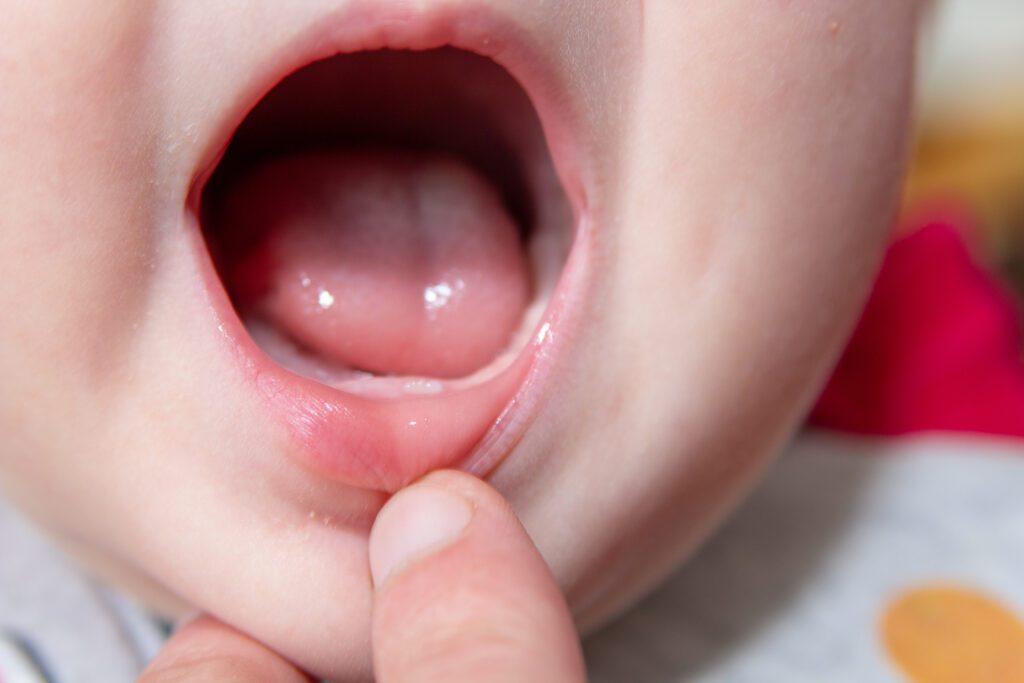 infant dentistry in Santa Rosa CA